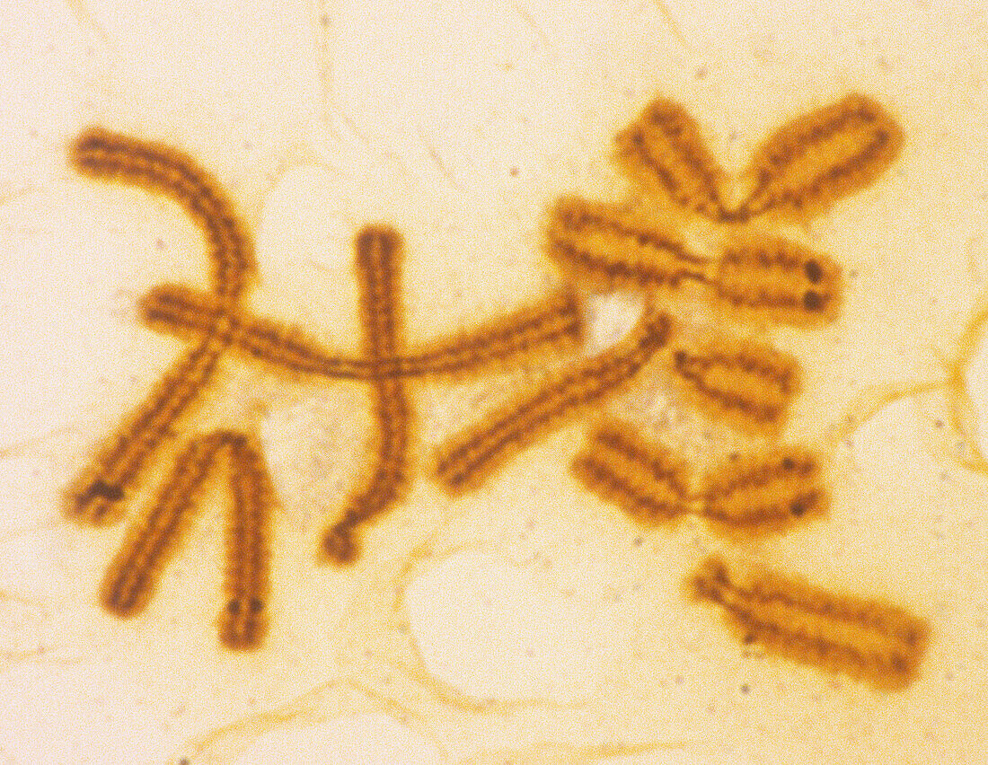 Condensed chromosomes, light micrograph