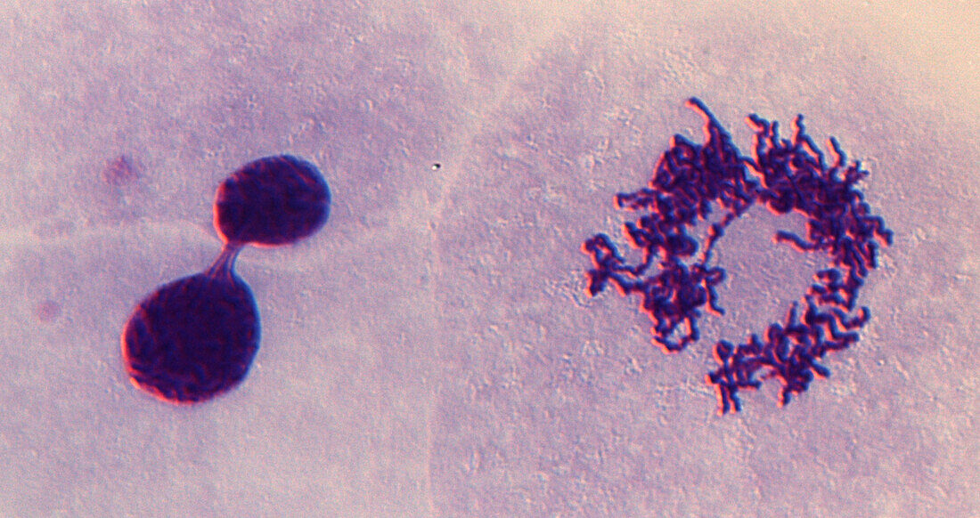 Mitosis in topoisomerase II inhibited cell, light micrograph