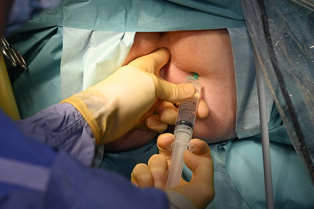Local anaesthetic injection