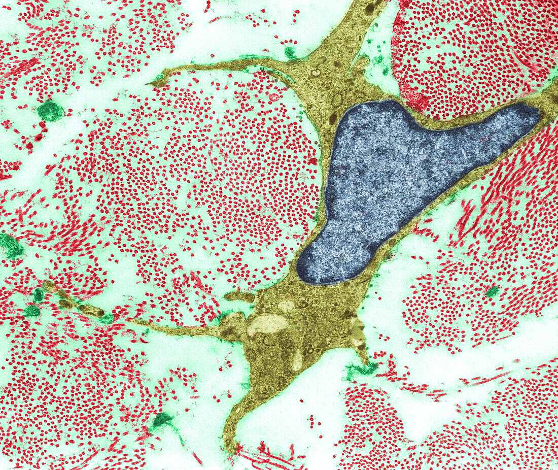 Fibroblast in connective tissue, TEM