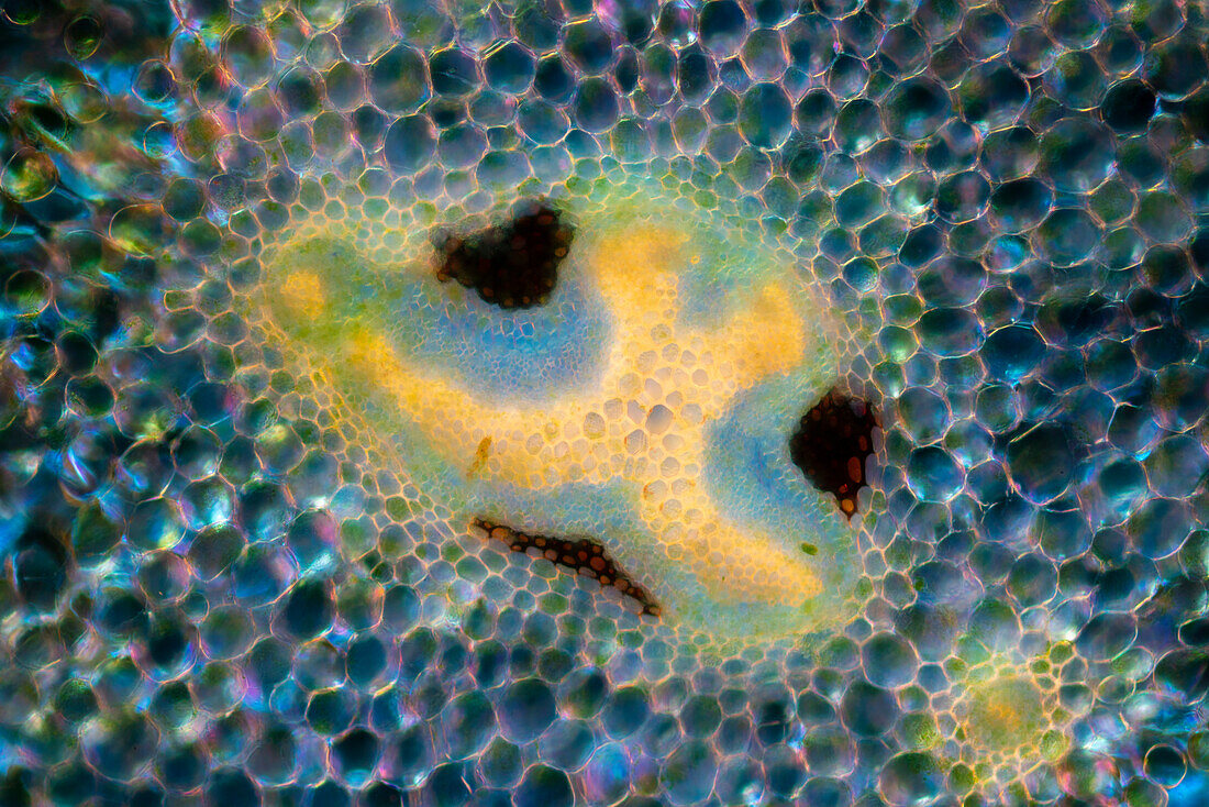 Hart's tongue fern (Asplenium scolopendrium) stem, light micrograph
