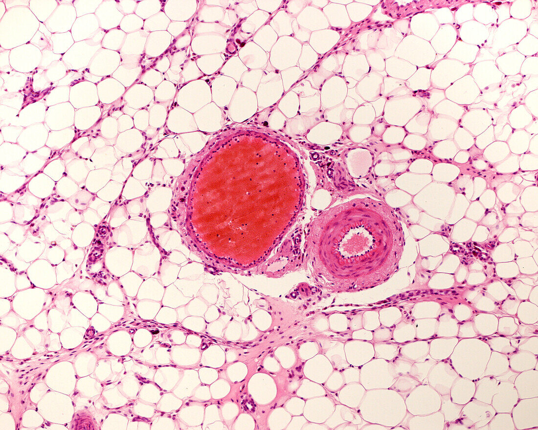 White adipose tissue, light micrograph