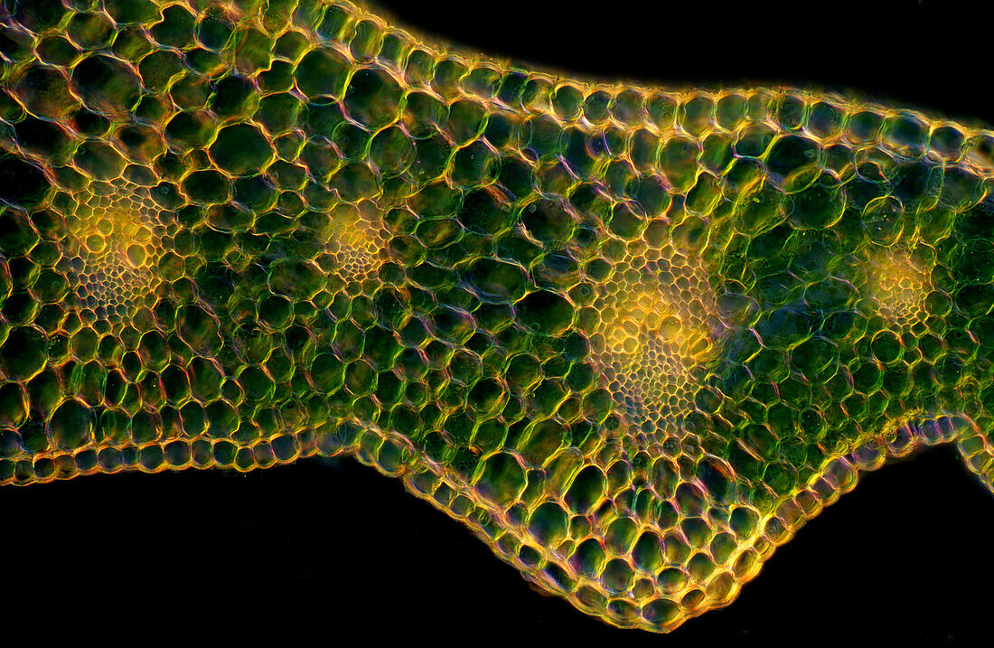 Marsh-marigold leaf, light micrograph