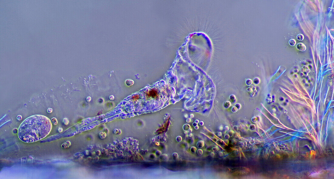 Rotifer carrying egg, light micrograph