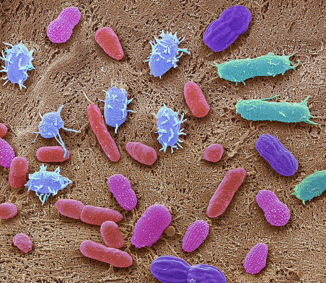 Faecal bacteria, SEM