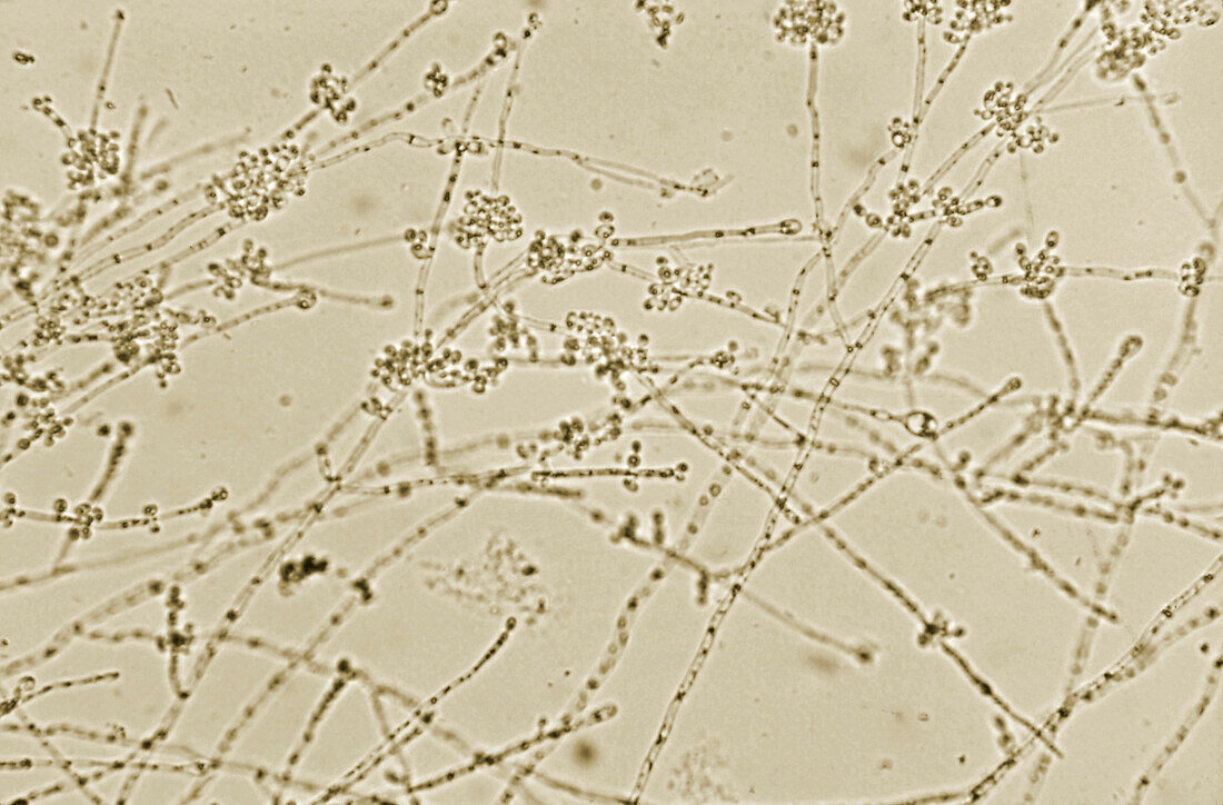 Candida albicans fungus, light micrograph