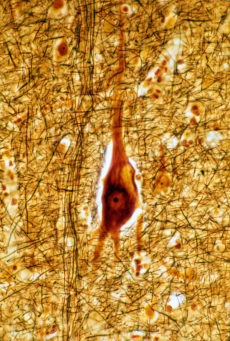 Lipofuscin in pyramidal neuron, light micrograph