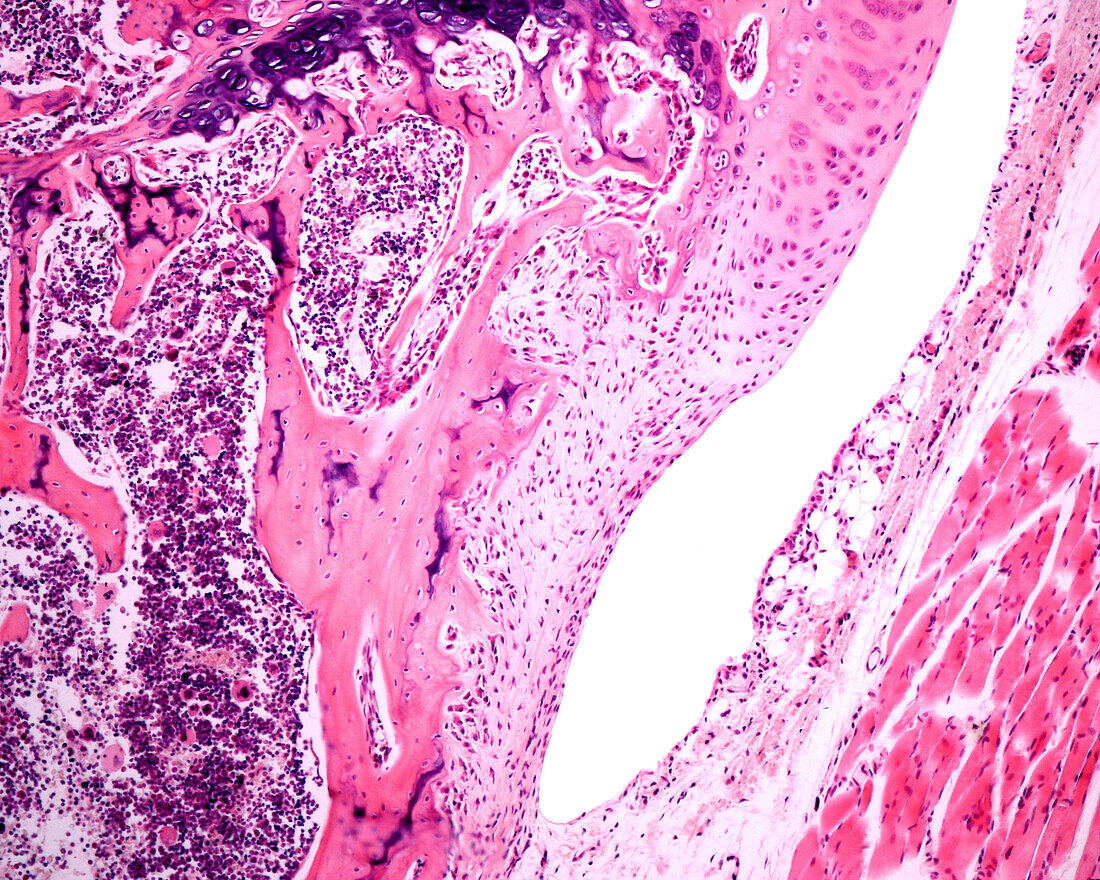 Joint synovial membrane, light micrograph