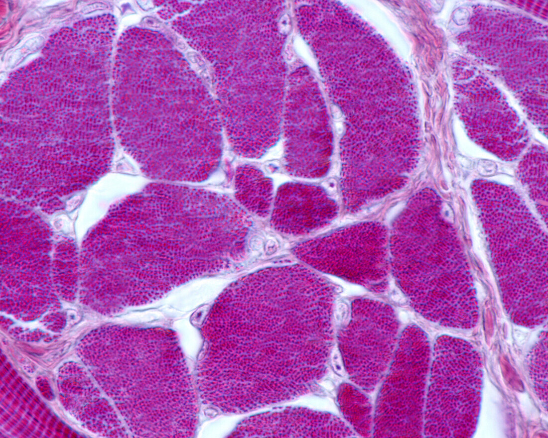 Striated muscle fibre, light micrograph