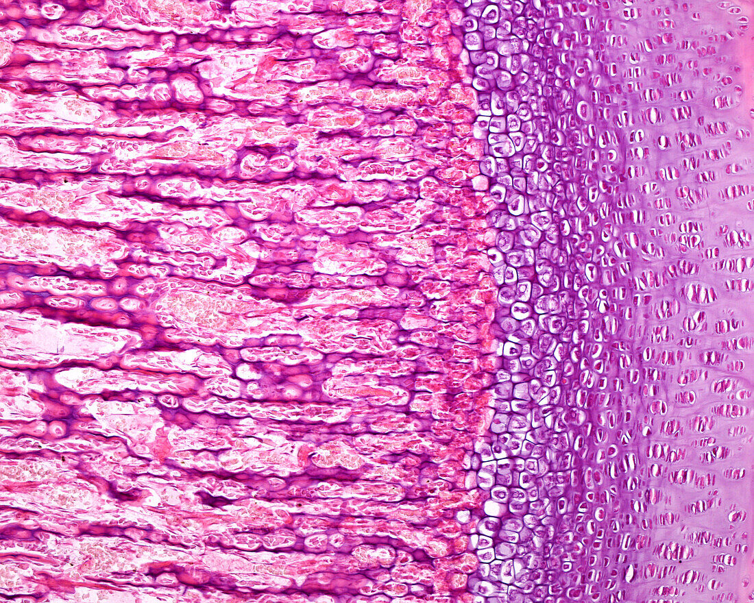 Developing bone, light micrograph
