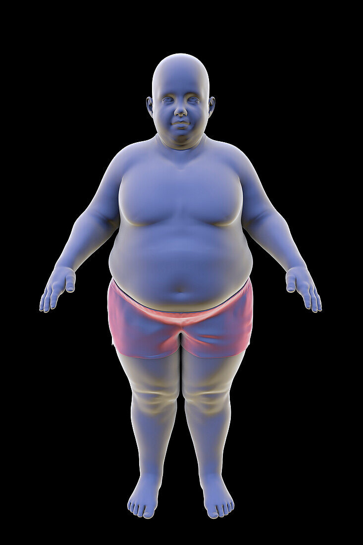 Obese boy, illustration