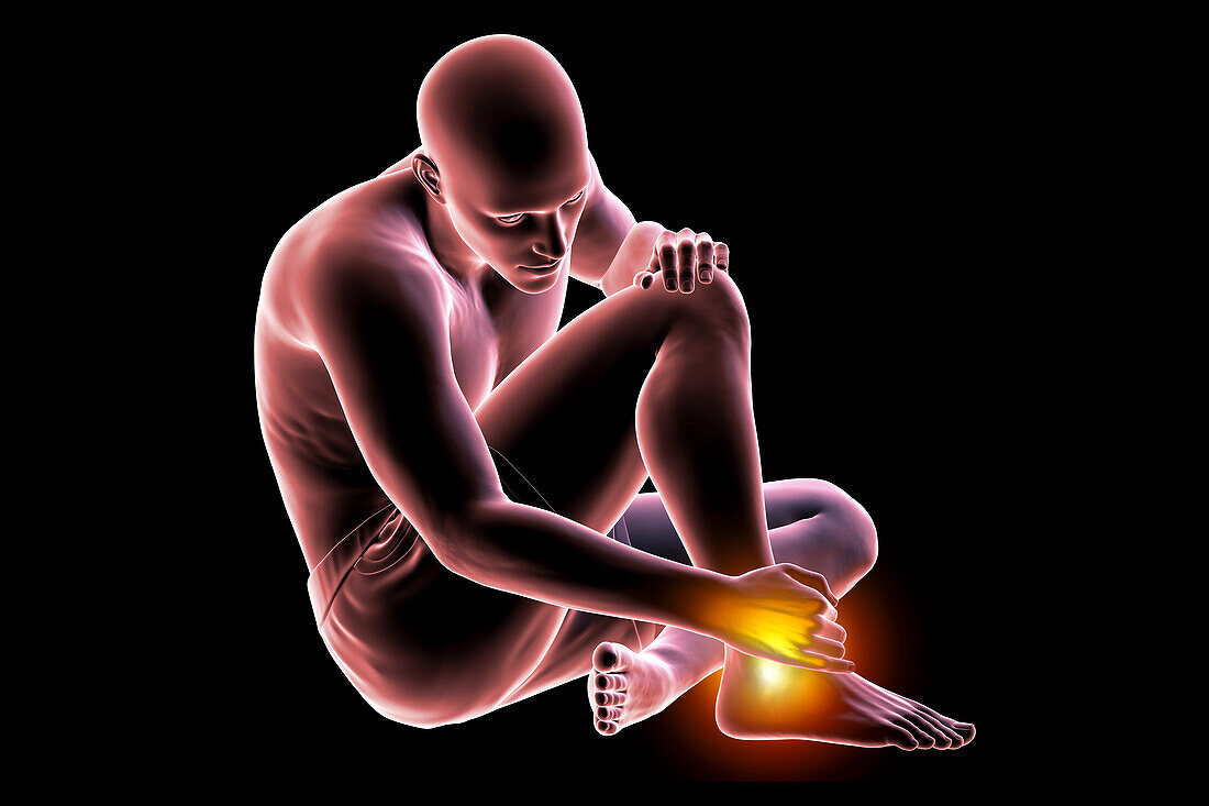 Man with ankle pain, illustration
