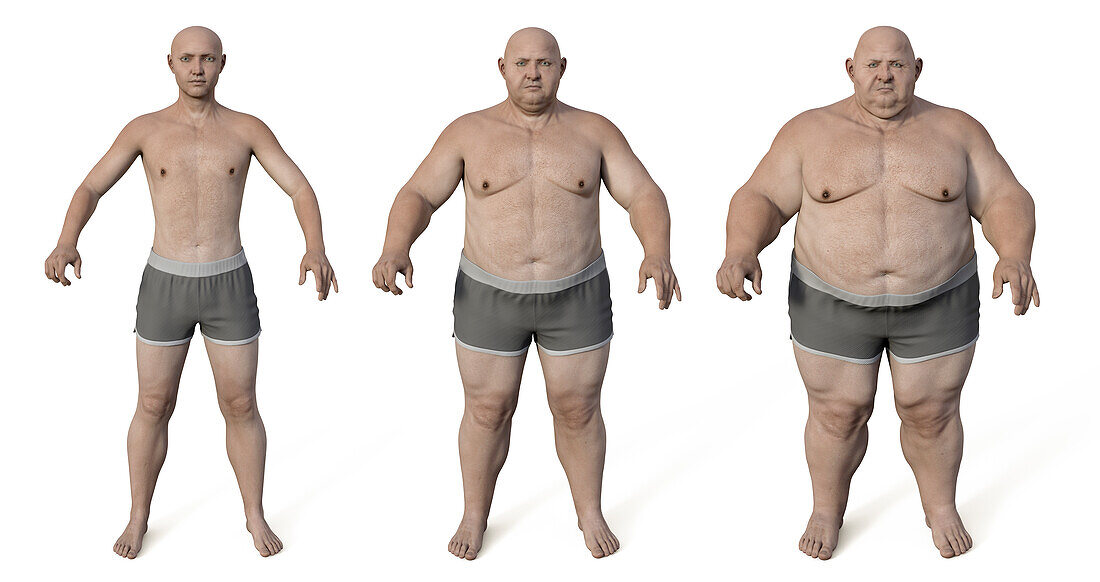 Man before and after gaining weight, illustration