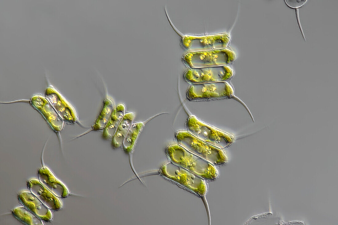 Scenedesmus quadricauda algae, light micrograph