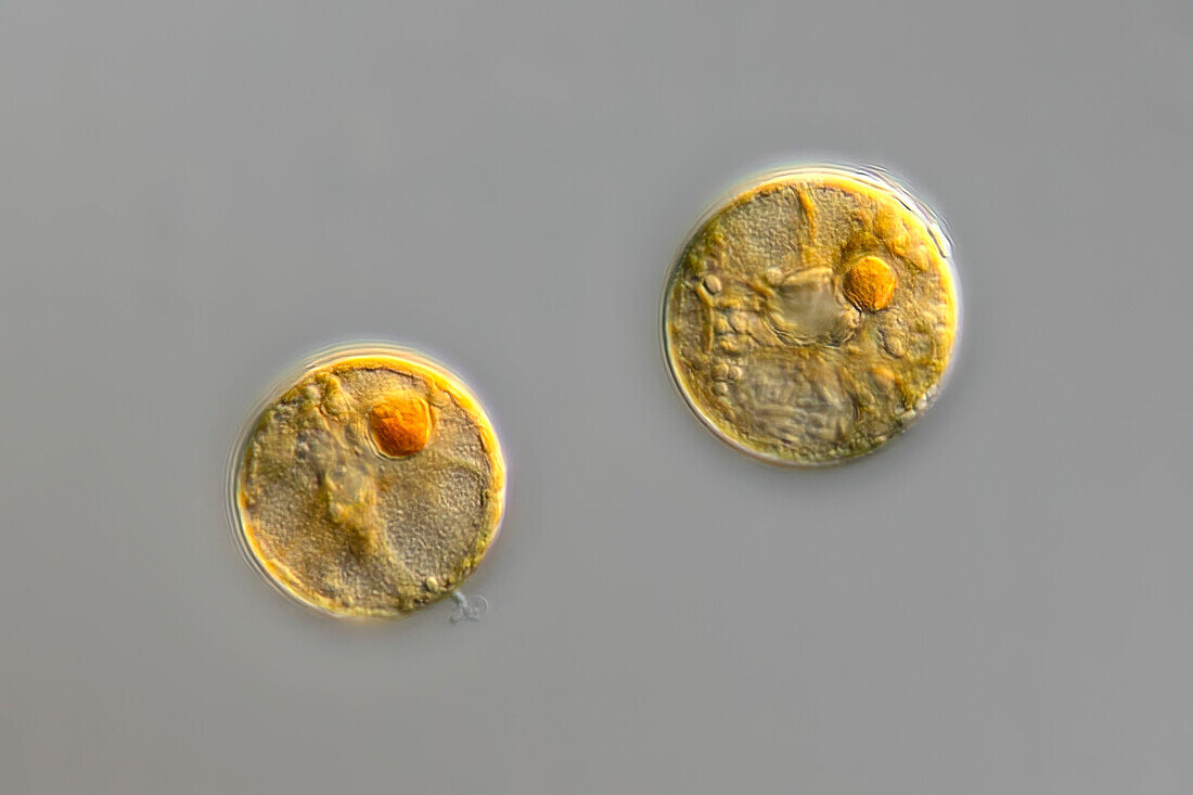 Leonella granifera algae, light micrograph