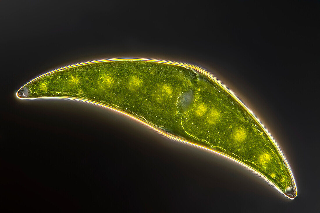 Closterium moniliferum alga, light micrograph