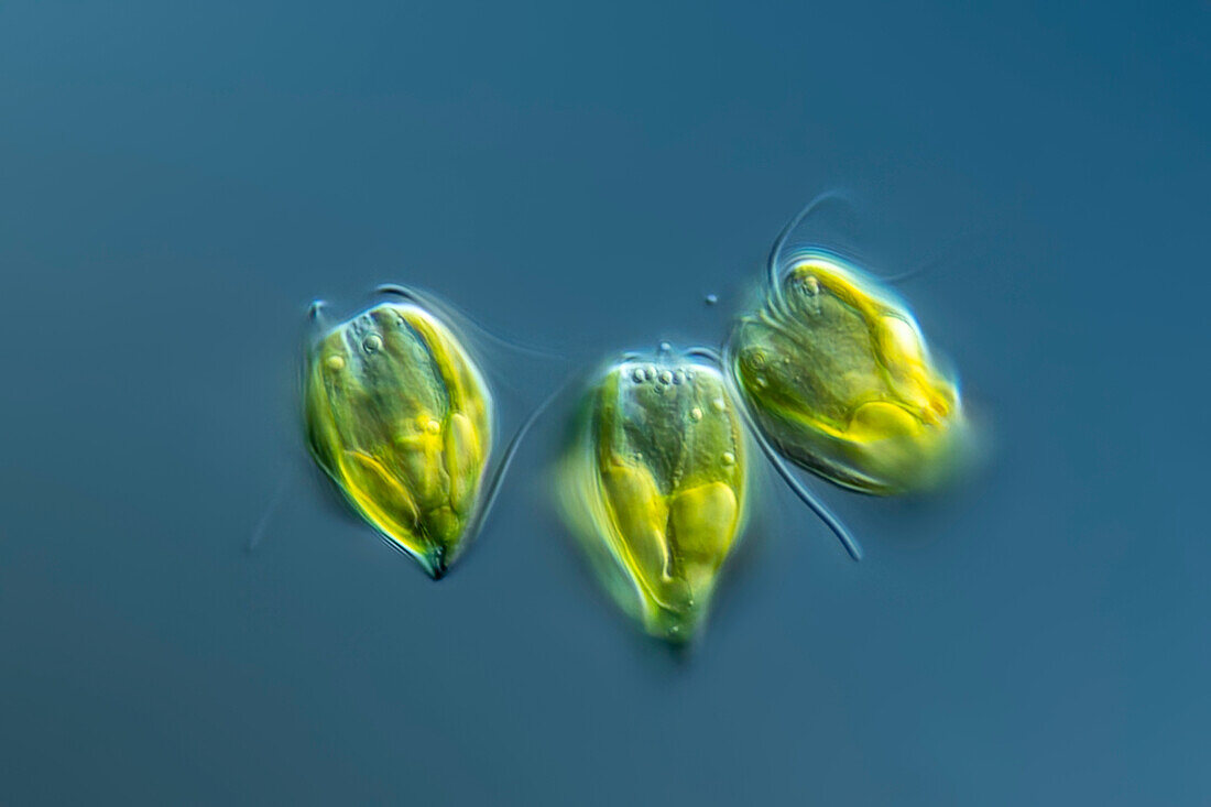 Pyramimonas amylifera algae, light micrograph