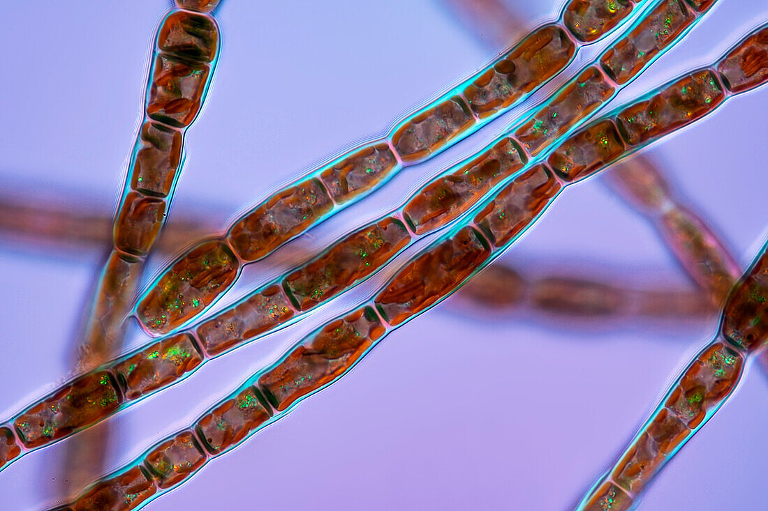 Tribonema sp. algae, light micrograph