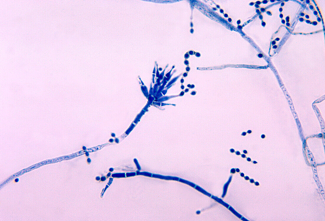 Talaromyces marneffei fungus, light micrograph