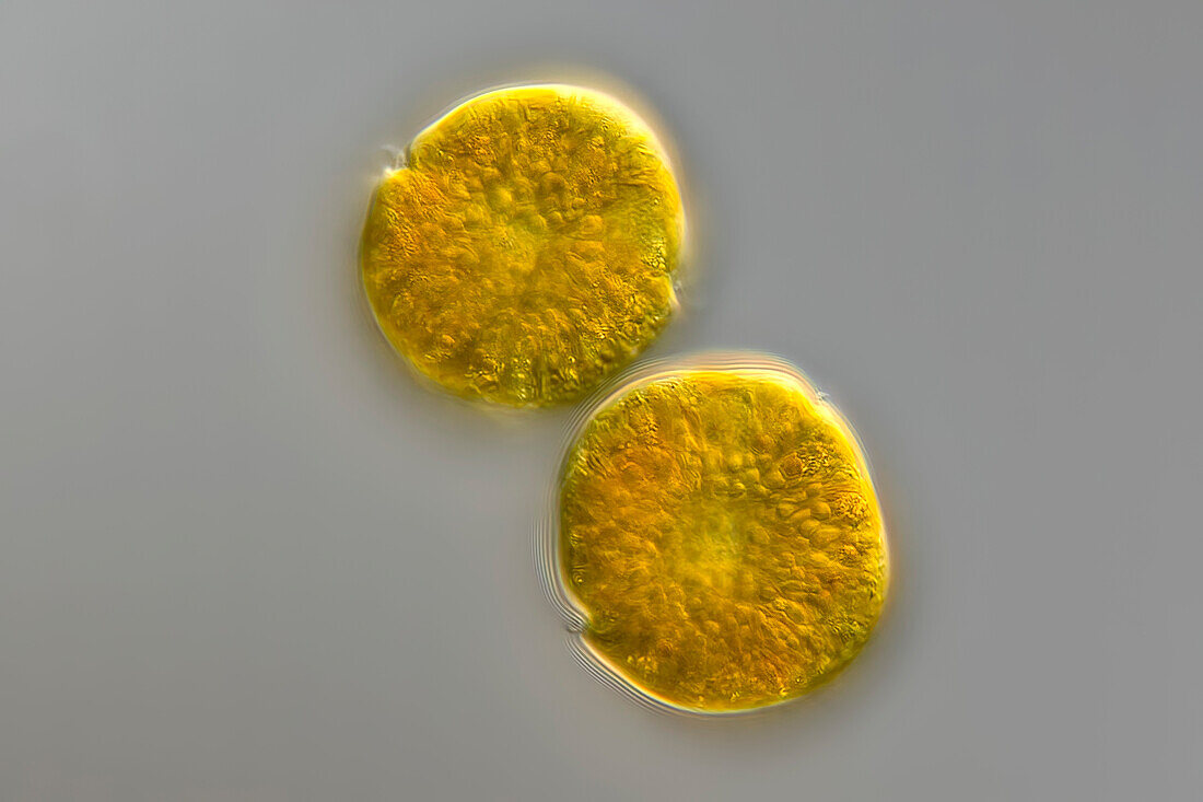 Woloszynskia algae, light micrograph