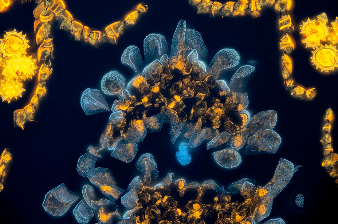 Daisy flower, fluorescent light micrograph