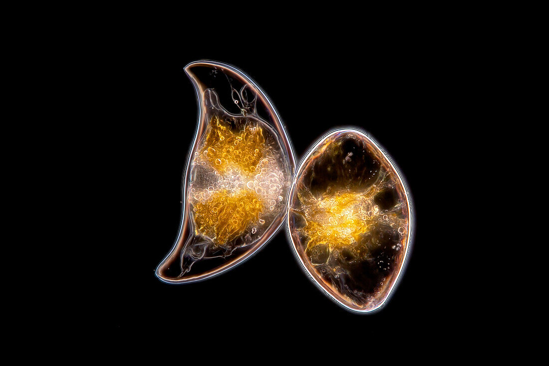 Pyrocystis lunula algae, light micrograph