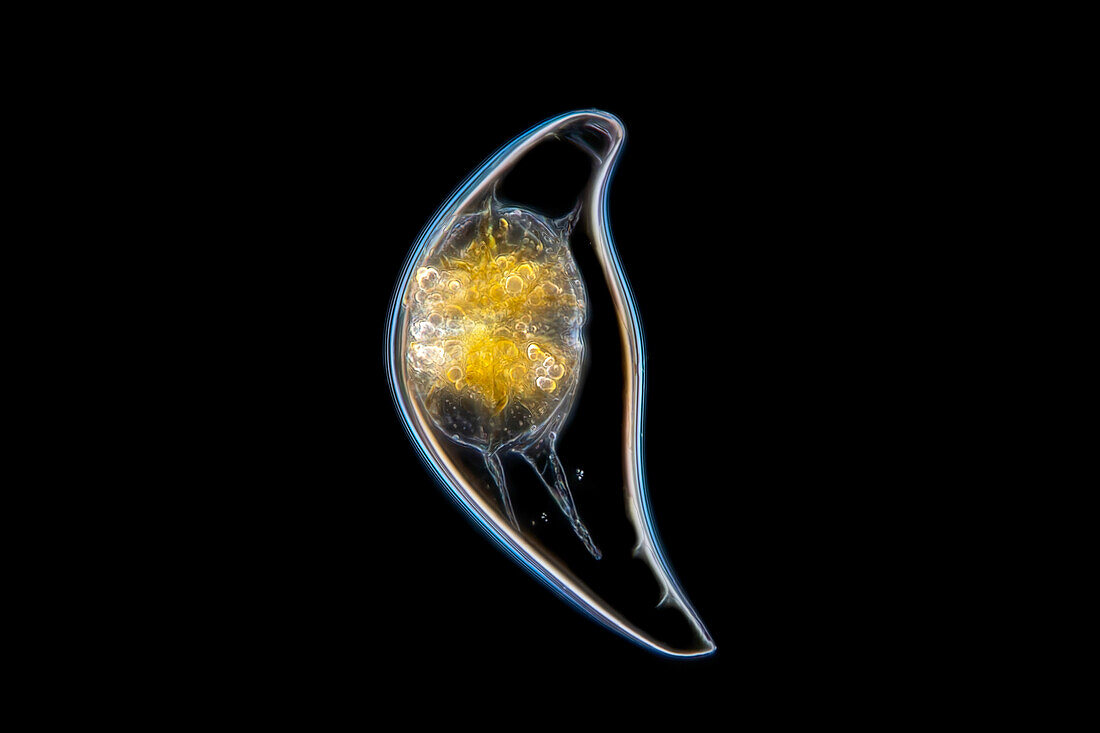 Pyrocystis lunula alga, light micrograph