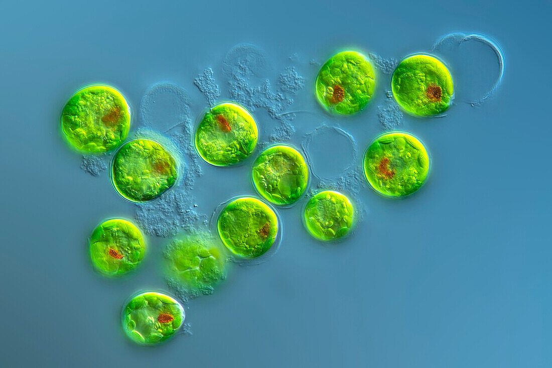 Trachelomonas volvocinopsis algae, light micrograph