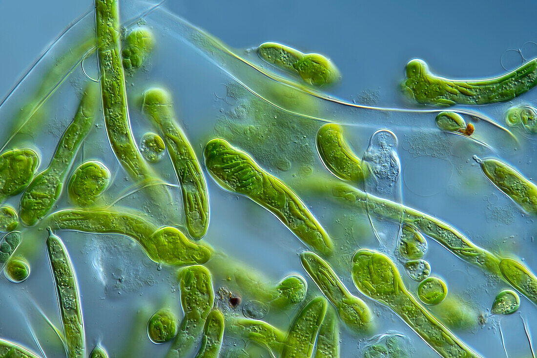 Ophiocytium algae, light micrograph