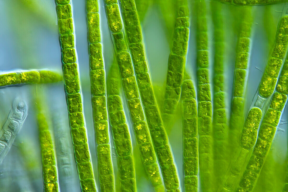 Tribonema algae, light micrograph
