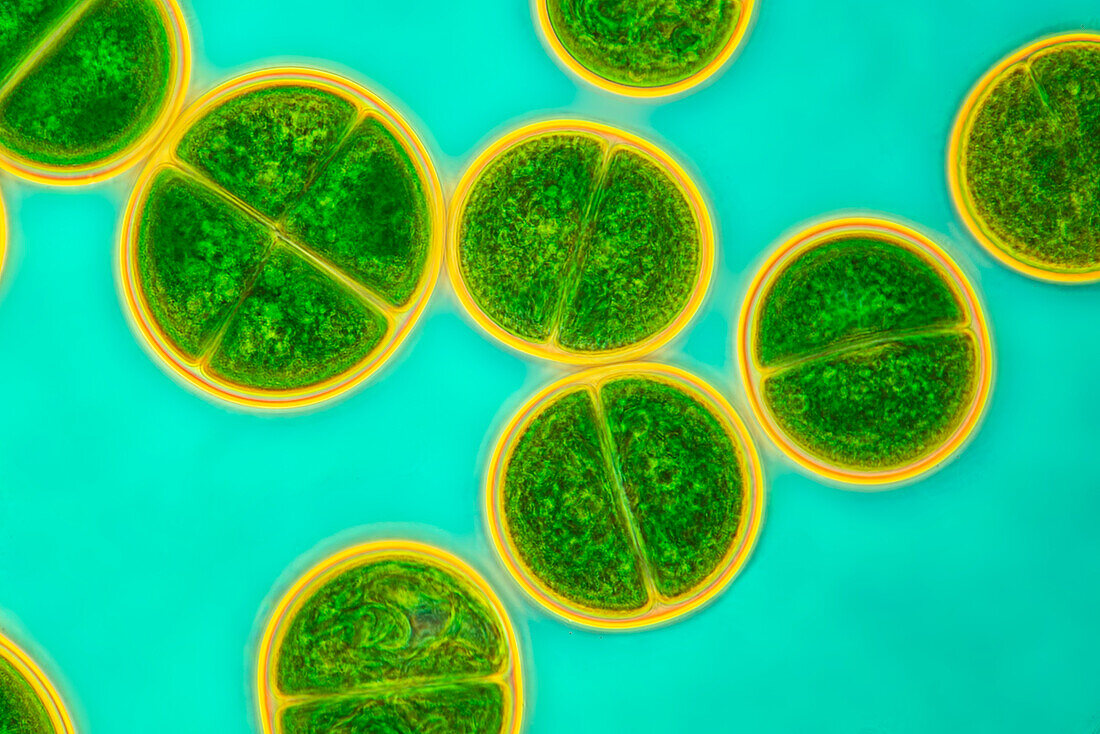 Chroococcus turgidus algae, light micrograph