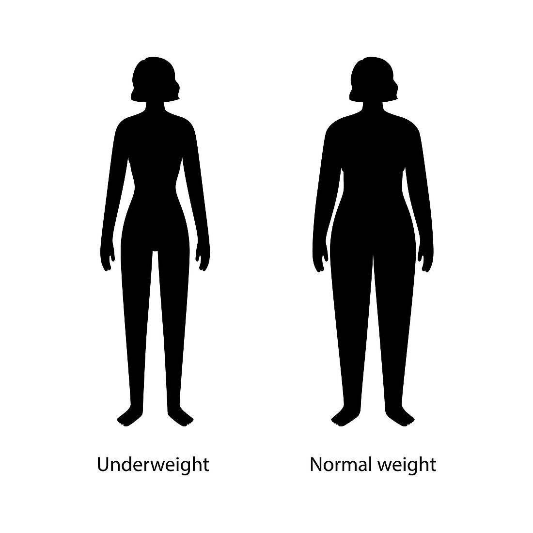 Underweight woman, illustration