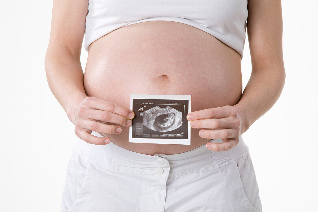 Schwangere Frau hält Ultraschallfoto