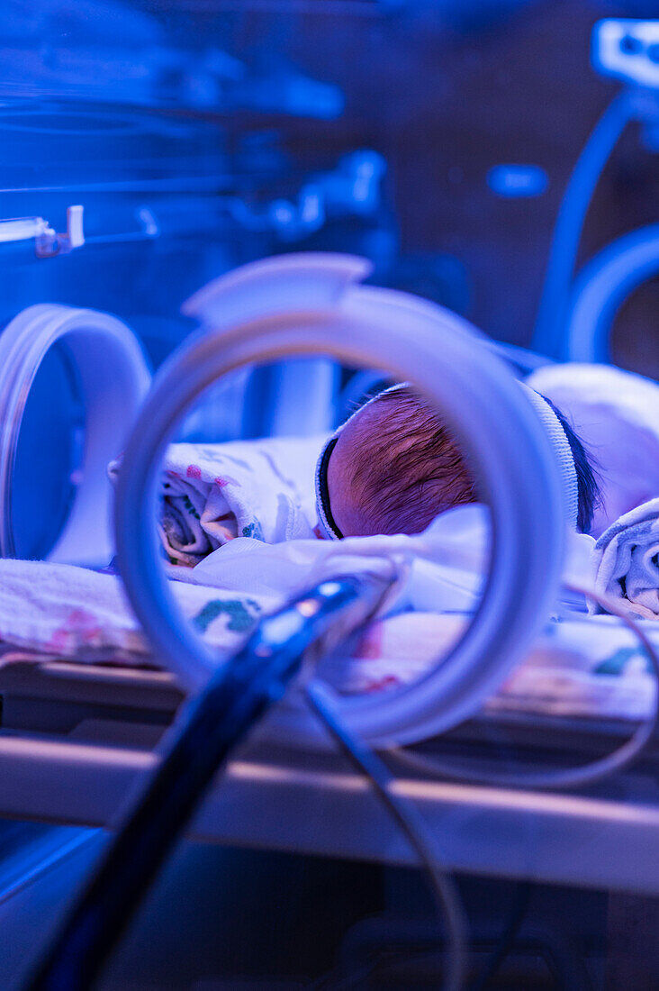 Newborn baby girl (0-1 months) in incubator