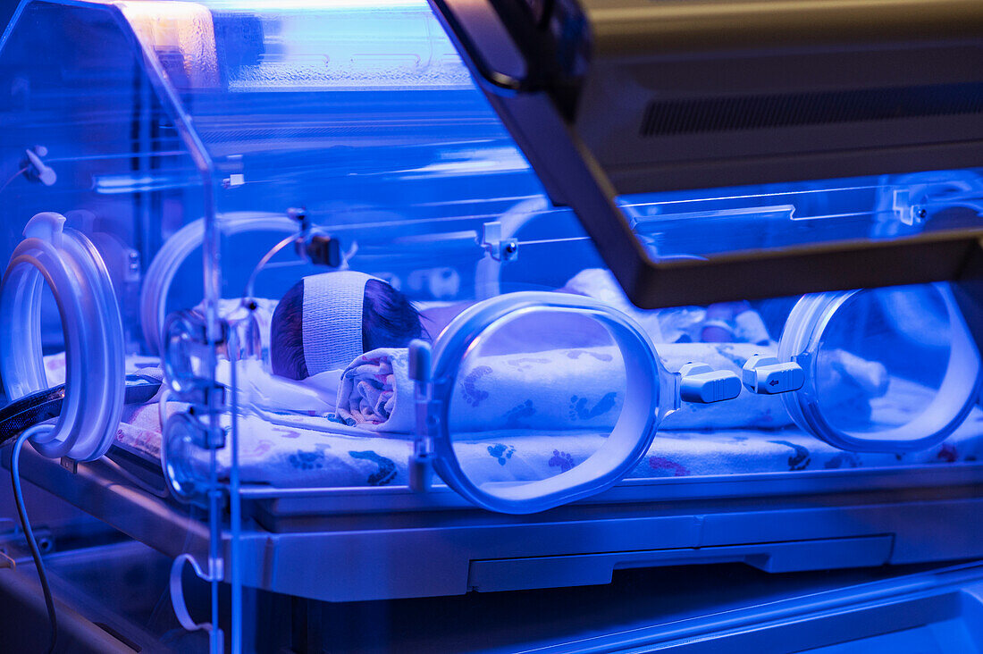 Wegen Gelbsucht behandeltes kleines Mädchen (0-1 Monate) im Inkubator