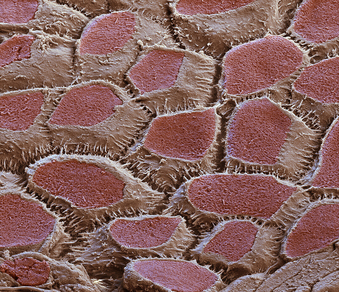 Ameloblast cells, SEM
