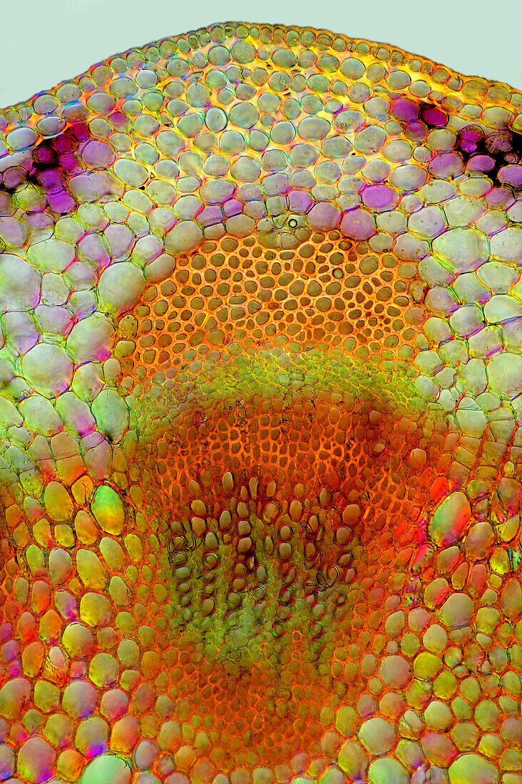 Senecio sp. vascular bundle, light micrograph