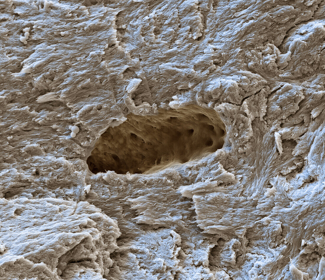 Lacuna in bone, SEM