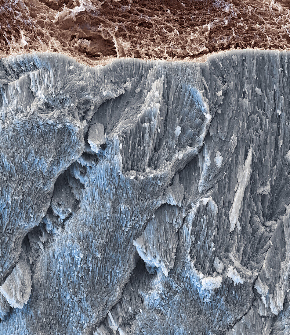 Unerupted tooth, SEM