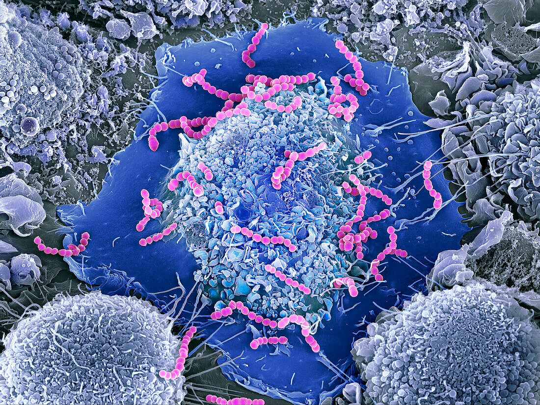 Macrophages infected with Streptococcus pyogenes, SEM