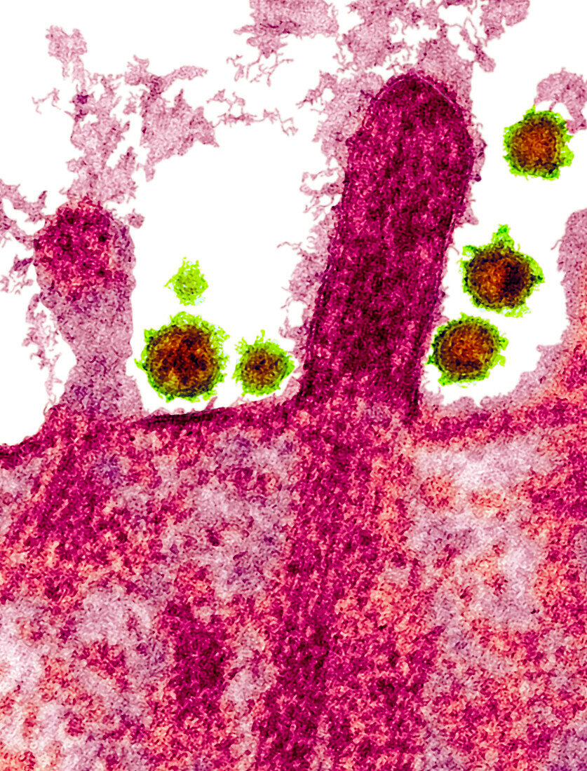 Cell infected by SARS-CoV-2 virus particles, TEM