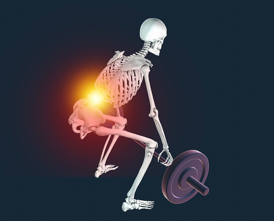 Skeleton with back pain lifting a barbell, illustration