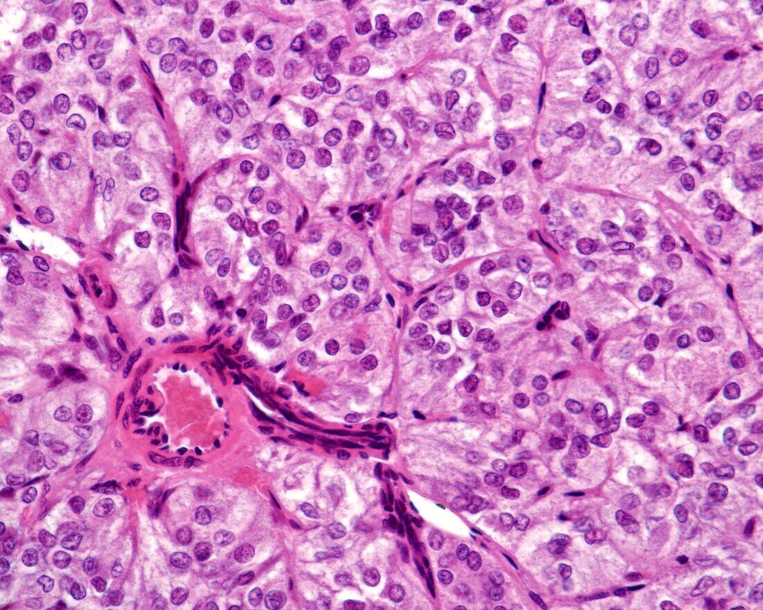 Human adrenal gland medulla, light micrograph