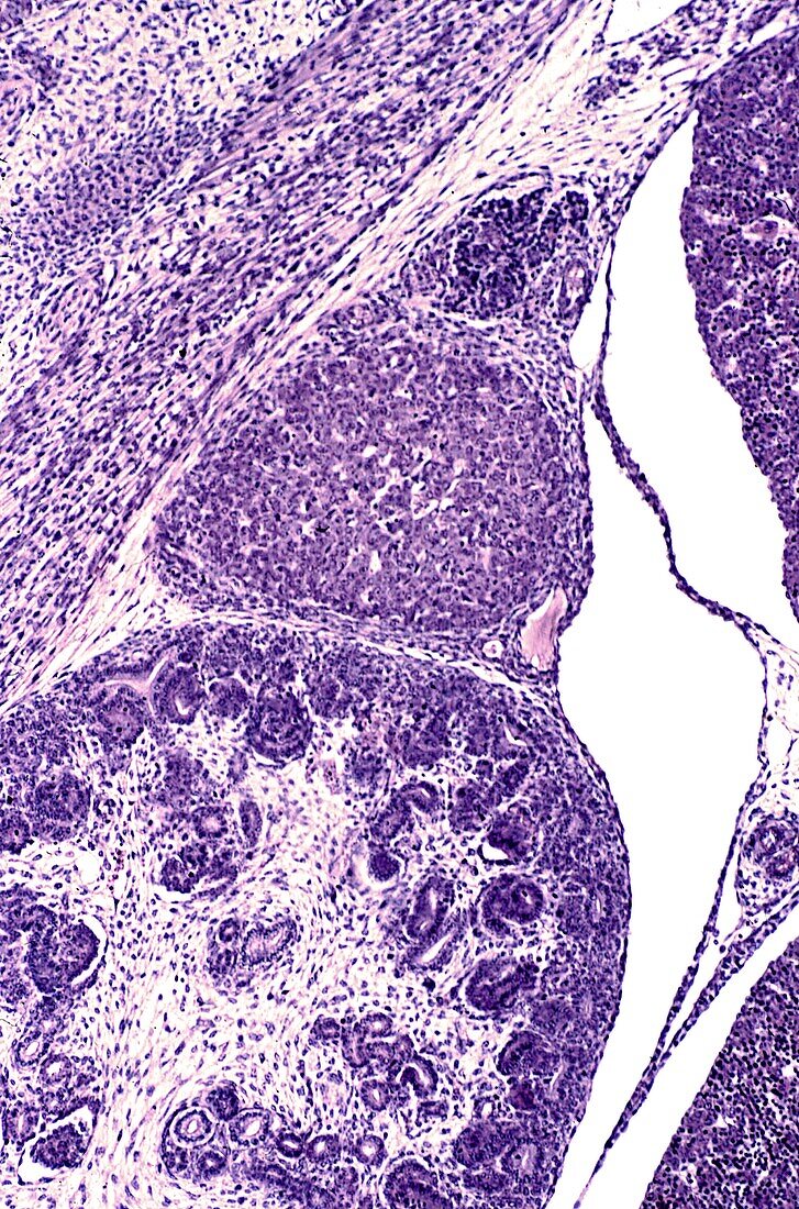 Foetal adrenal gland, light micrograph