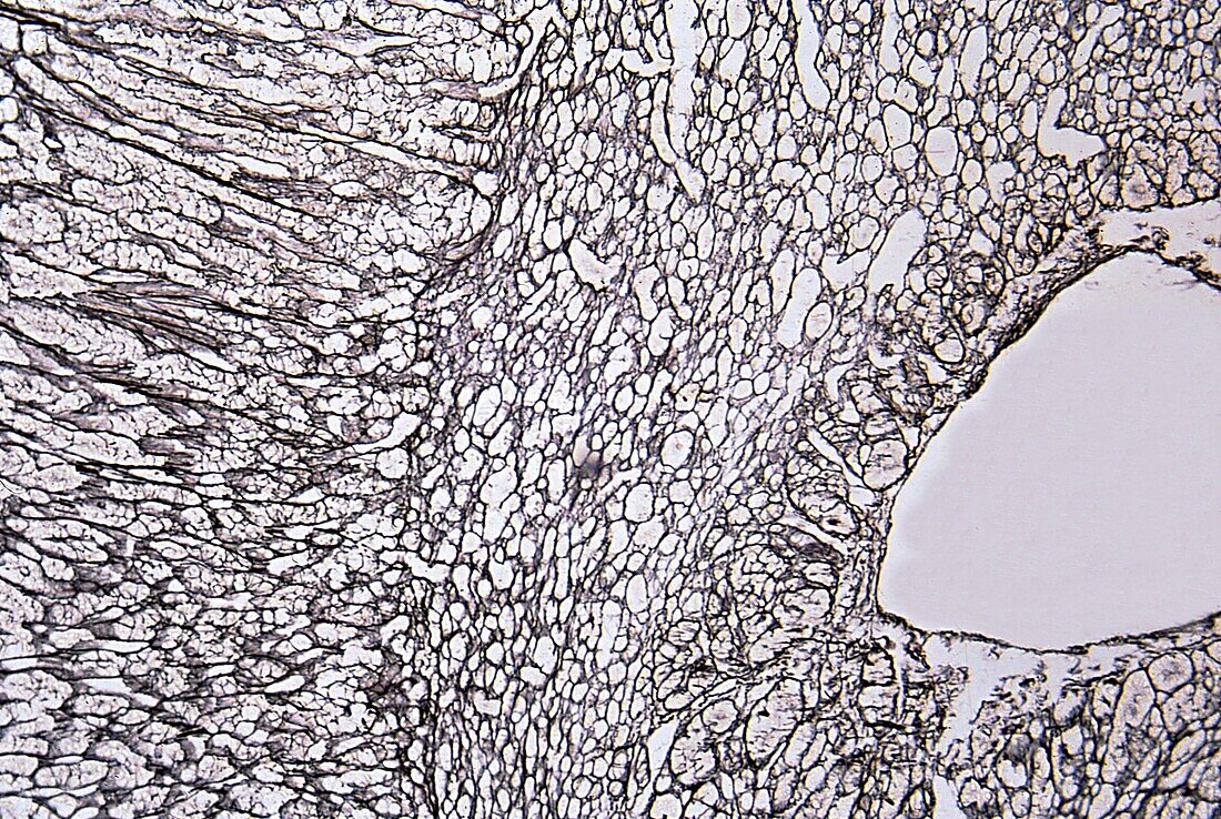 Human adrenal gland cortex and medulla, light micrograph