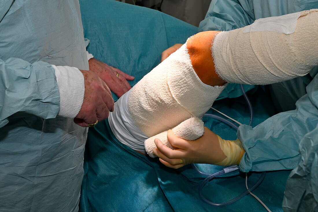 Bandaging of patient's leg after excision of skin cancer