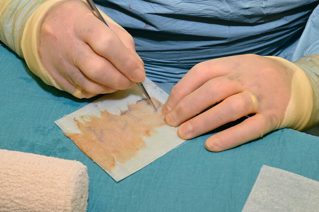 Surgeon preparing skin graft