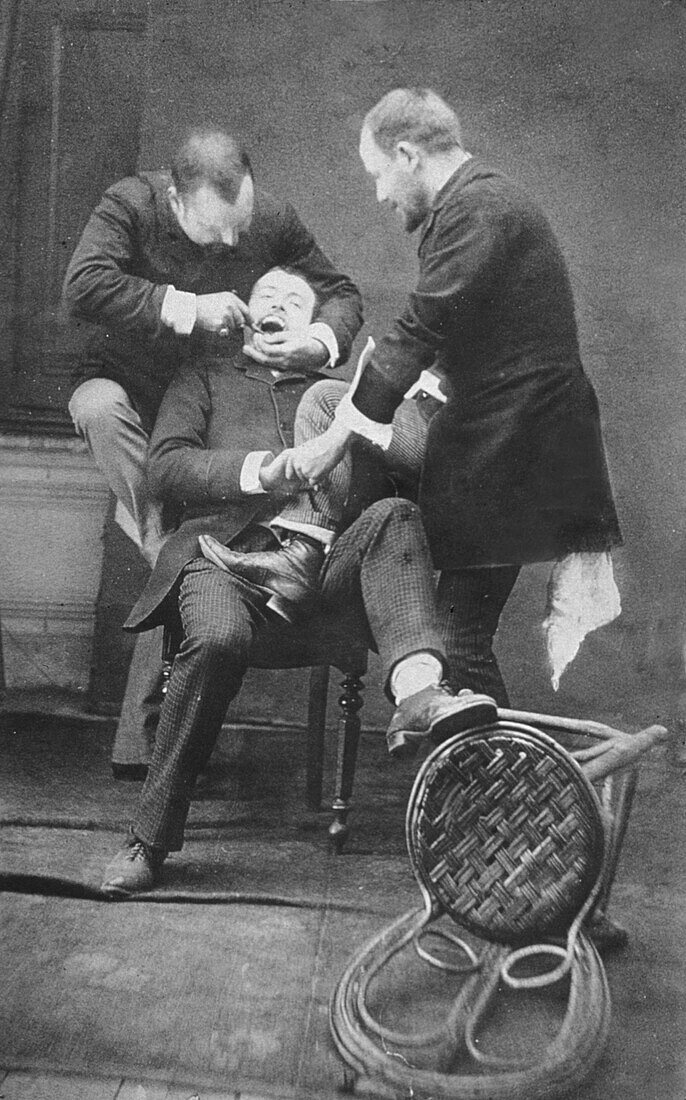 19th century tooth extraction