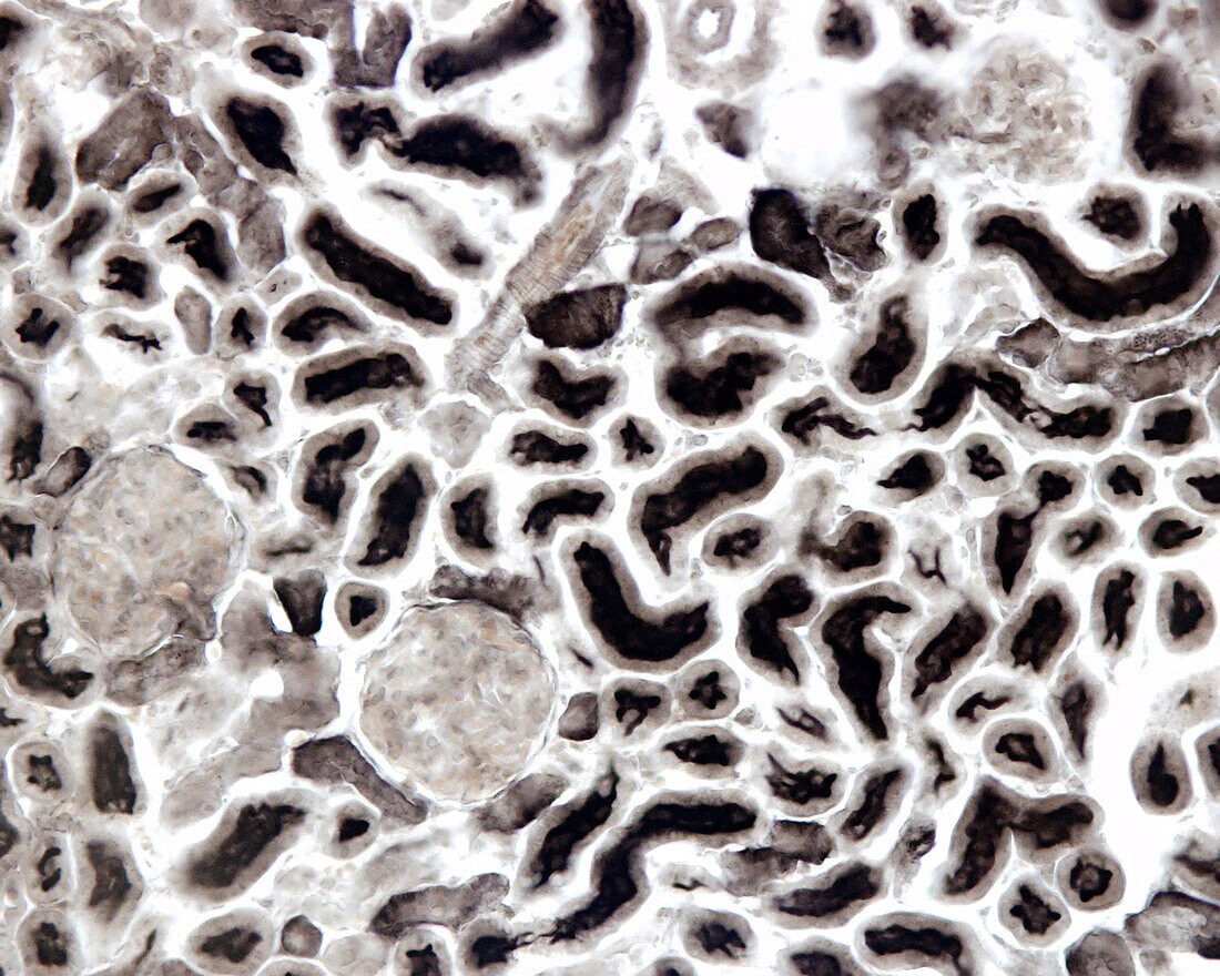 Kidney stained for alkaline phosphatase, light micrograph