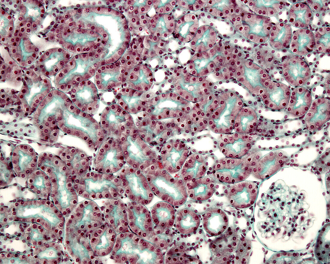 Kidney stained with Massonâ??s trichrome, light micrograph